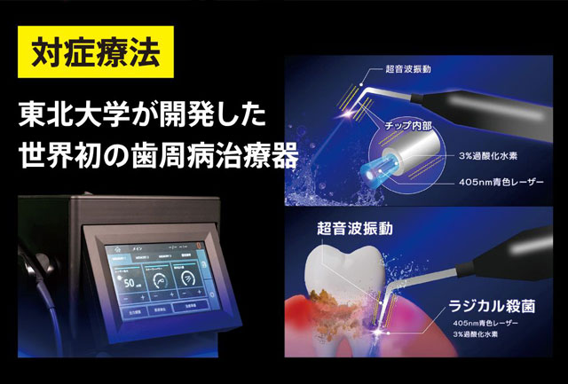 ブルーラジカルの照射